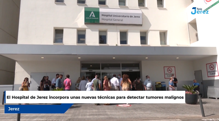 el hospital de jerez incorpora unas nuevas técnicas para detectar